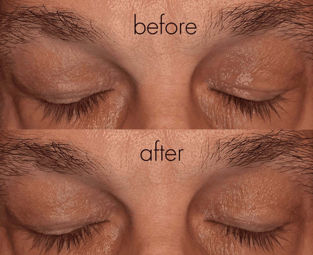 RoC Dual Eye Cream Reviews Before and After